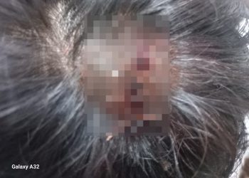 दबंगों ने बस चालक पर धारदार हथियार से हमला कर किया घायल
